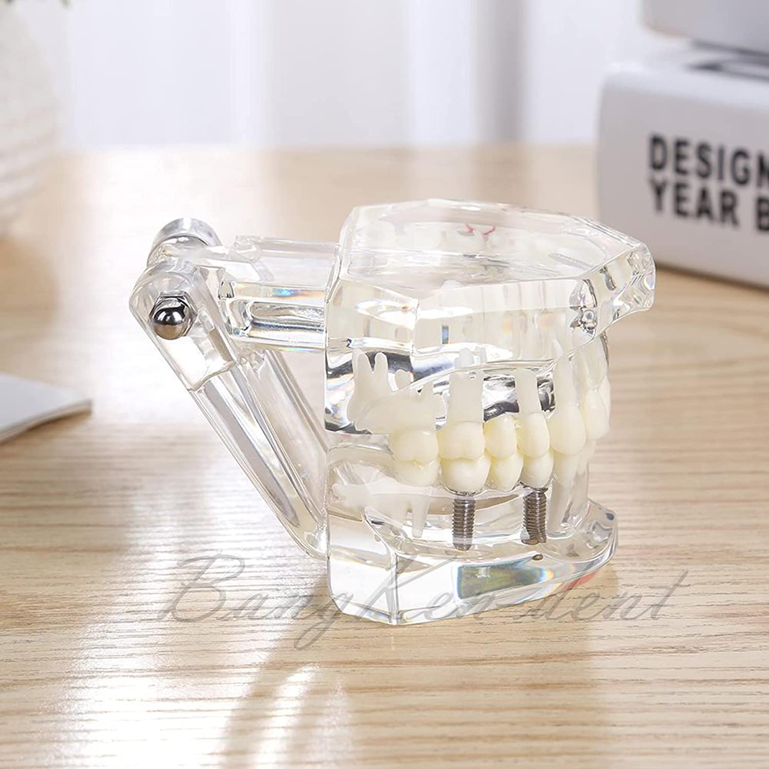 Dental Teeth Model Implant Model Teach Study Demo Tooth Analysis Demonstration Teeth Restoration 200
