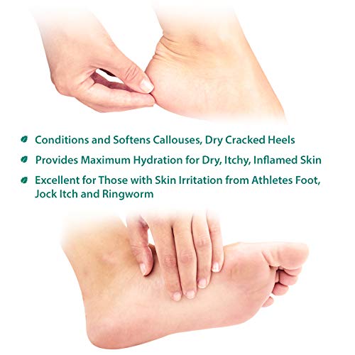Extra-Strength Tea Tree Foot & Body Cream by Purely Northwest-for Sweat Prone Areas, Soothes Itchy C