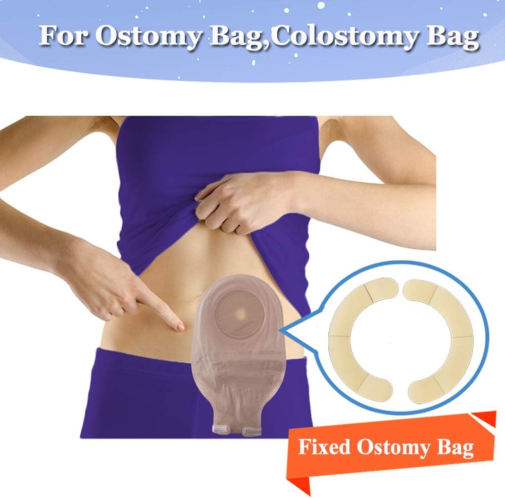 Ostomy Barrier Strips Ostomy Bag Colostomy Supplies Ileostomy Bags Elastic Barrier Strips (Pack of 2