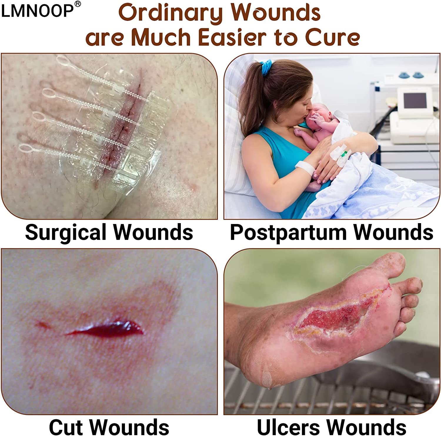 LMNOOP® Bed Sore Cream, Maximum Strength Wound Care Ointment for