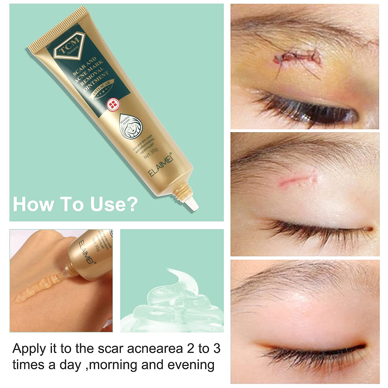 2 Pack TCM Scar Removal Gel and Acne Mark Removal Cream Ointment, Acne Scar Removal Cream Skin Repai