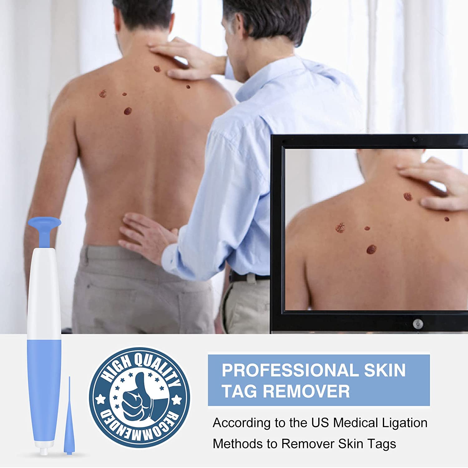 Skin Tag Remover, Skin Tag Removal Kit Device for Small to Medium (2mm