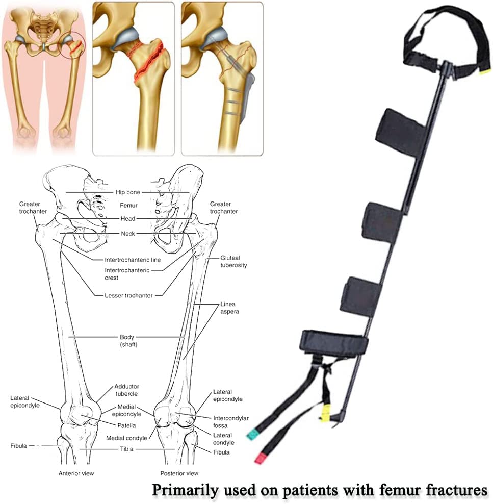 First Aid Leg Traction Splint, Outdoor Calf Feet Thigh Immobilization Device for Emergency Rescue & 
