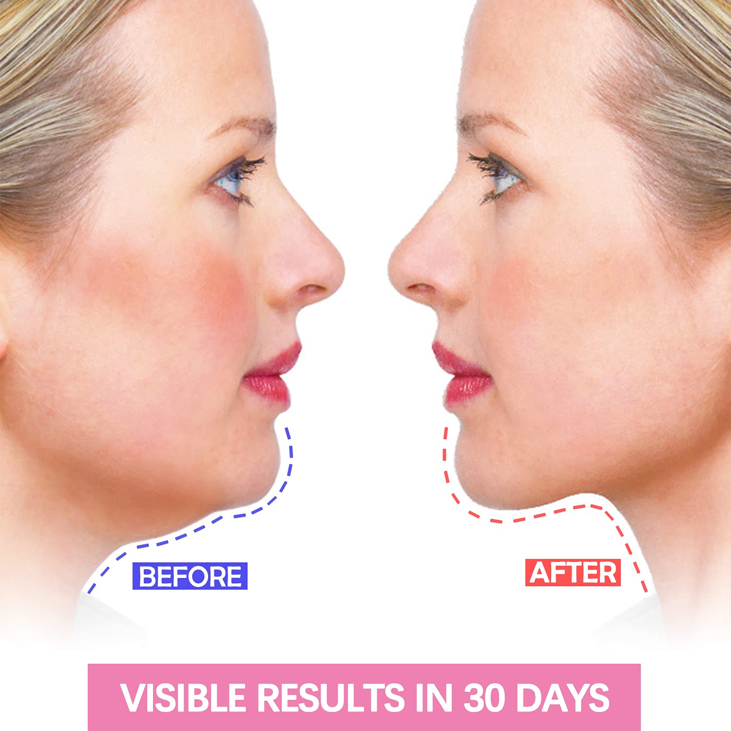 Double Chin Reducer, Face Slimming Strap, V Shaped Mask Chin UP Face Lifting Belt for women, Anti- W