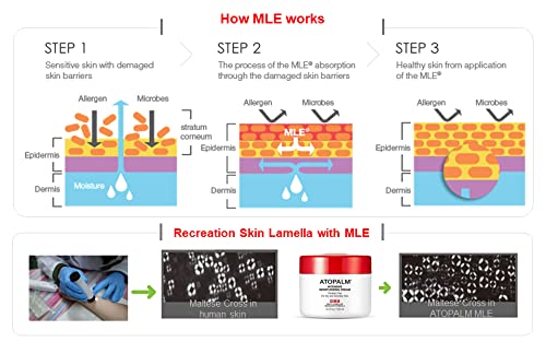 ATOPALM Intensive Moisturizing Cream, Original Formula, Rich Moisturizing Cream, Gentle, Replenishes