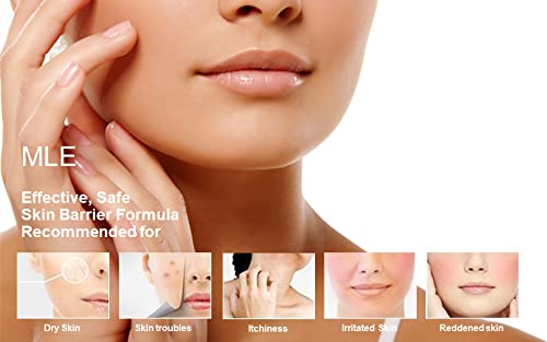 ATOPALM Intensive Moisturizing Cream, Original Formula, Rich Moisturizing Cream, Gentle, Replenishes