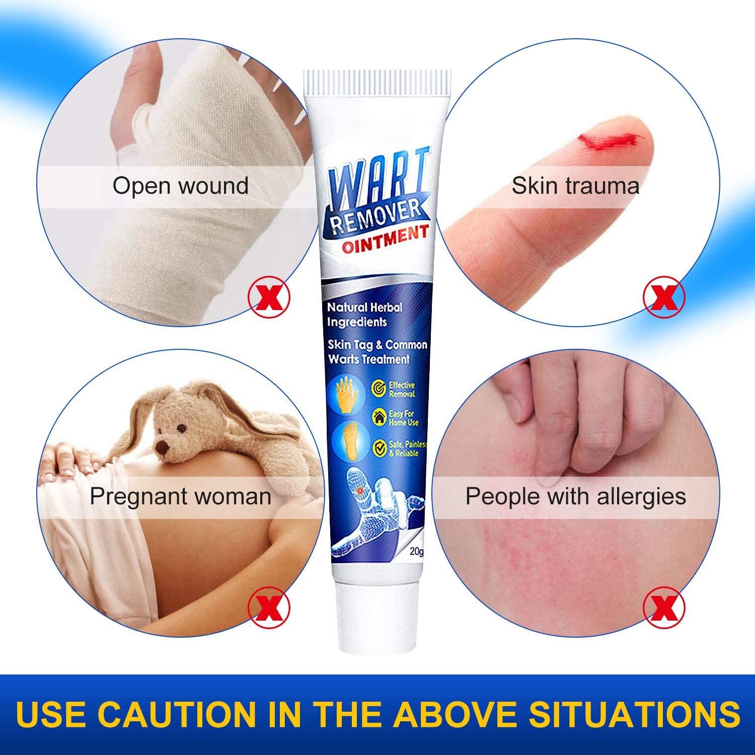 Wart Remover Cream,Skin Tag and Common Warts Treatment,Callus Painlessly, Effective and Safe