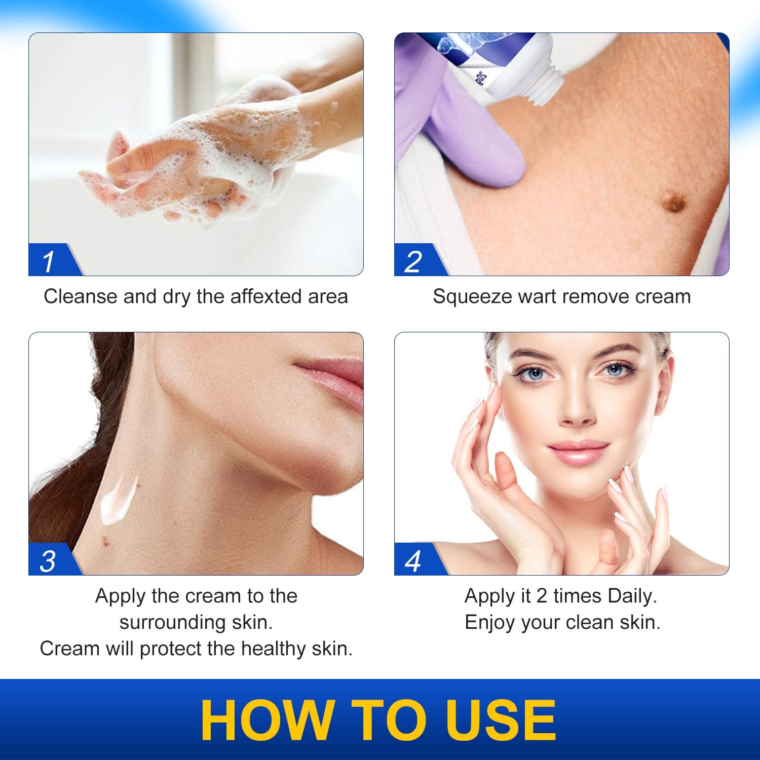 Wart Remover Cream,Skin Tag and Common Warts Treatment,Callus Painlessly, Effective and Safe