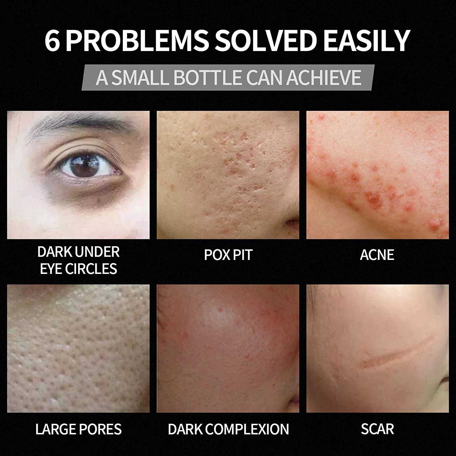 immetee BB Cream for Men, Tinted Moisturizer for Face, Waterproof Concealer for Dark Circles & Spots