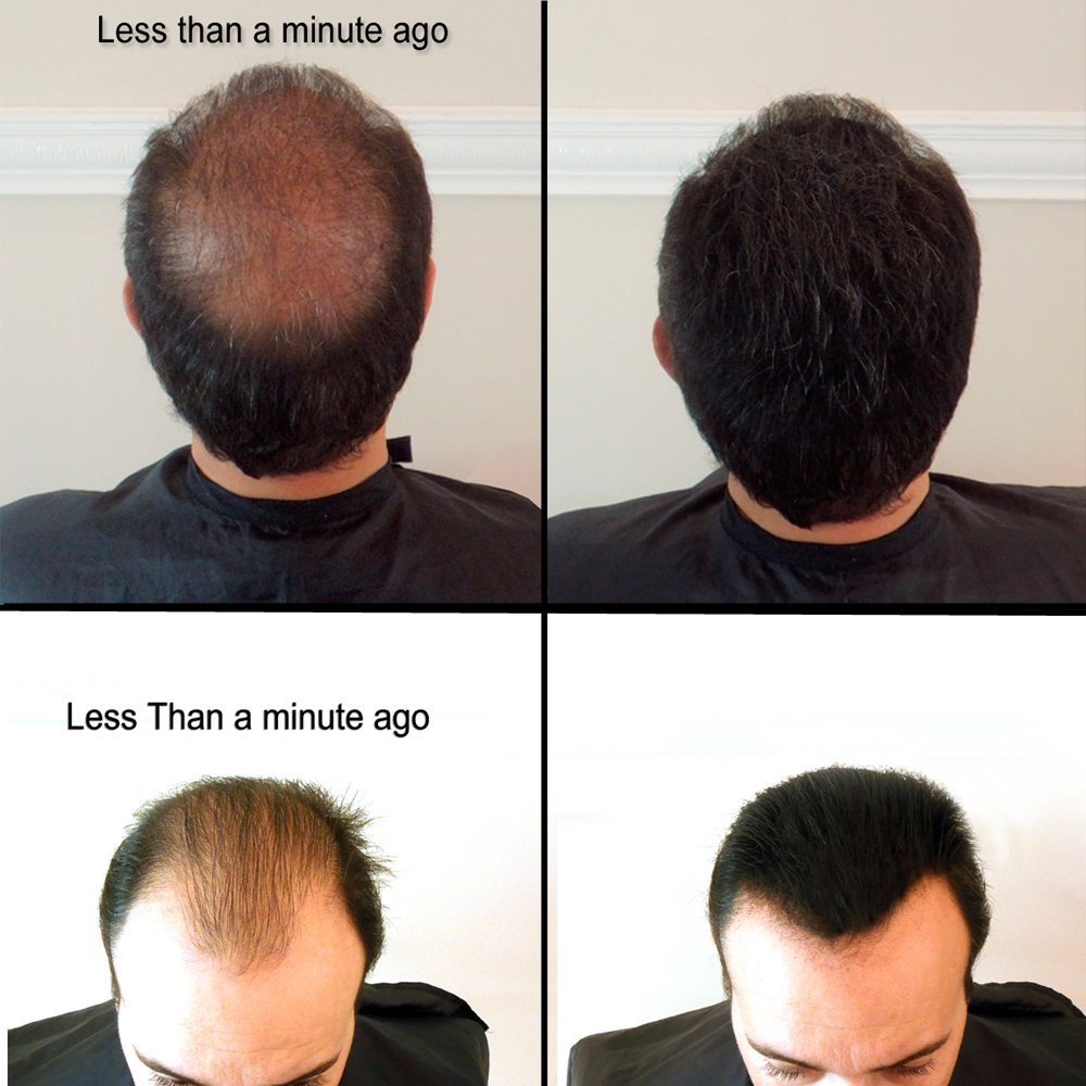 IMMETEE Keratin Hair Building Fibers Powder Conceal Instantly for Thinning Hair,Cover Up Hair Loss N