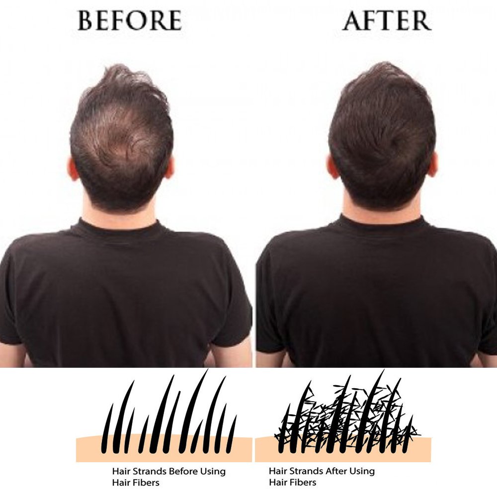 IMMETEE Keratin Hair Building Fibers Powder Conceal Instantly for Thinning Hair,Cover Up Hair Loss N