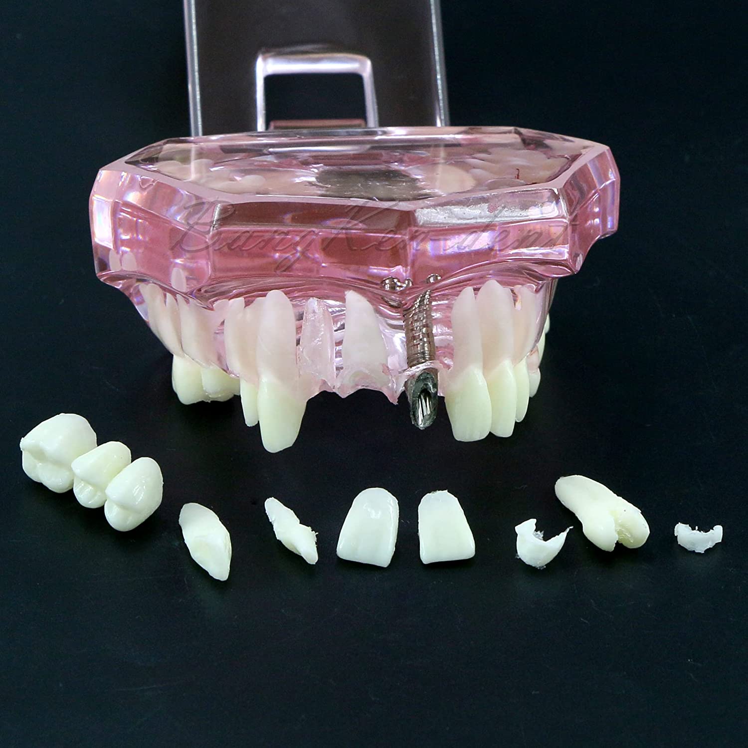 Dental Teeth Model Implant Typodont Model Teach Study Demo Tooth Analysis Demonstration Teeth Restor