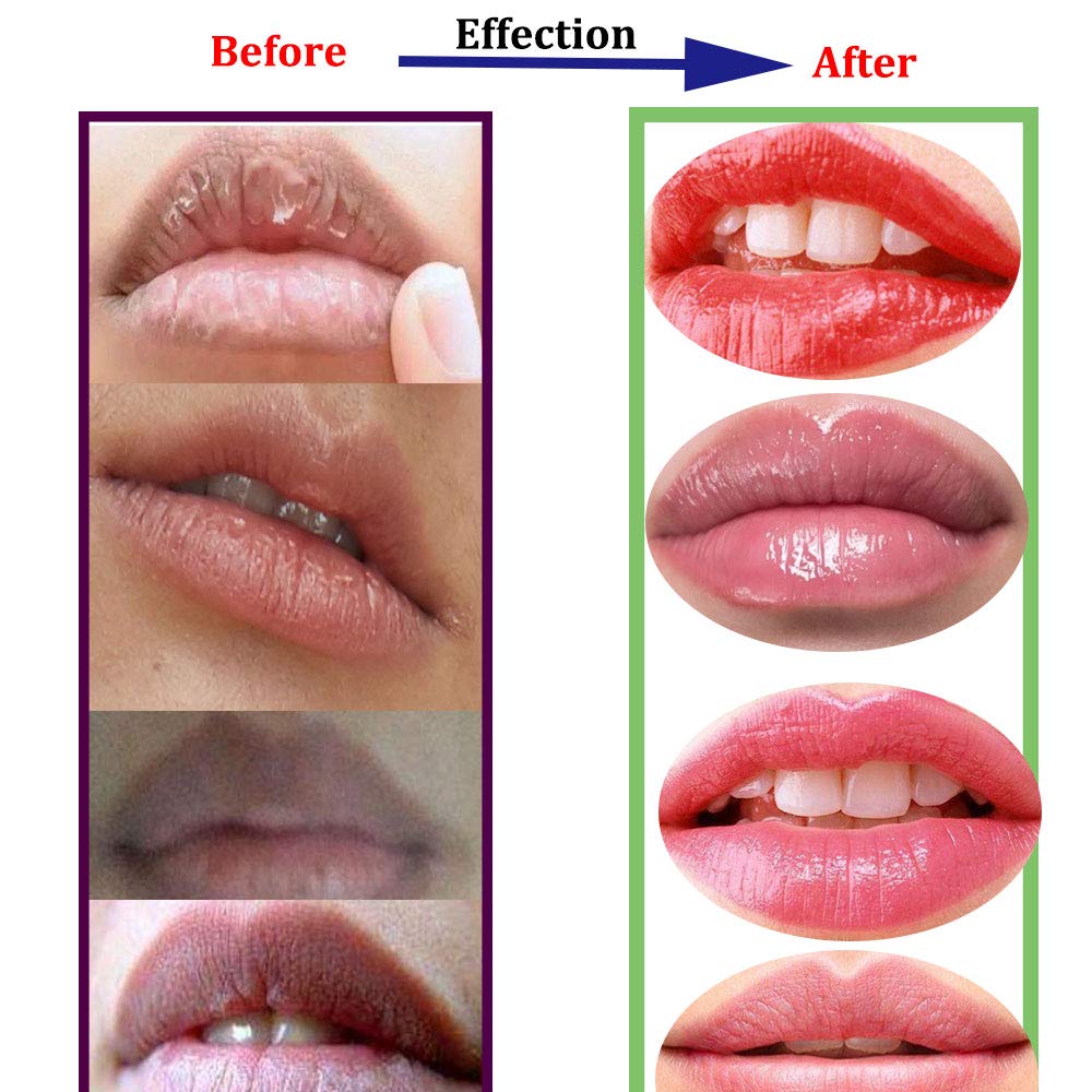 Adofect 30 Pieces Collagen Crystal Lip Masks, Collagen Lip Pads Great for Moisturizing, Remove Dead 