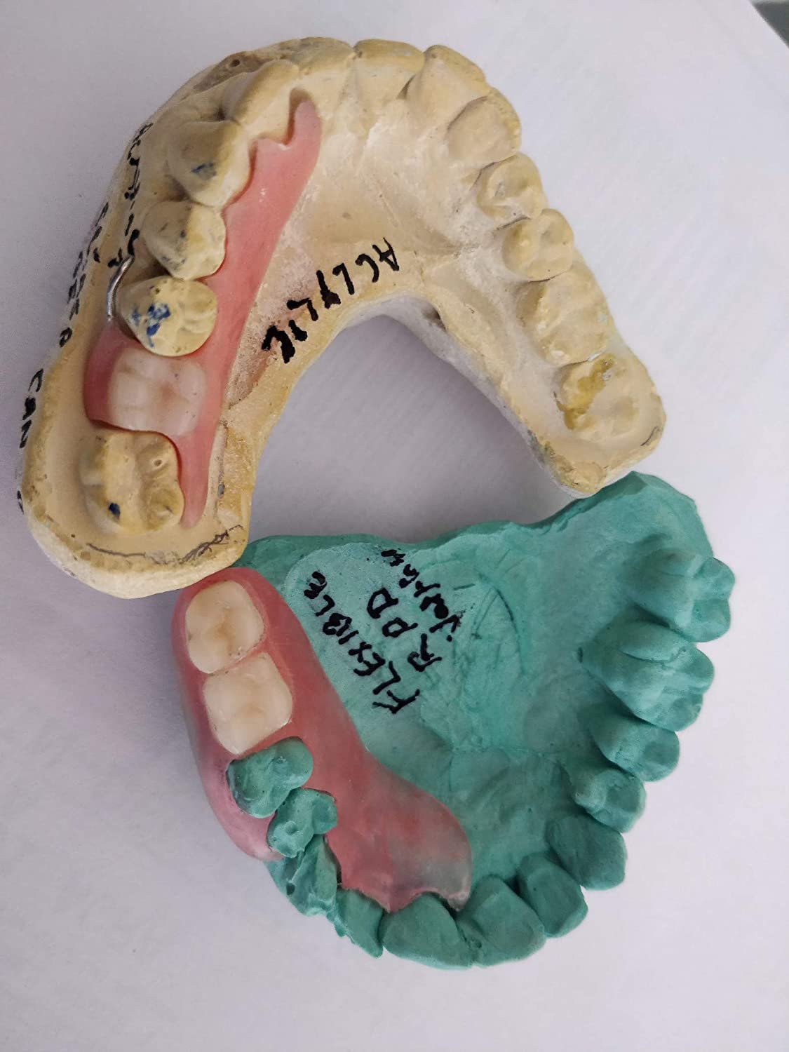 Affordable Flexible Valplast Customized Partial Denture (Pink, Valplast)