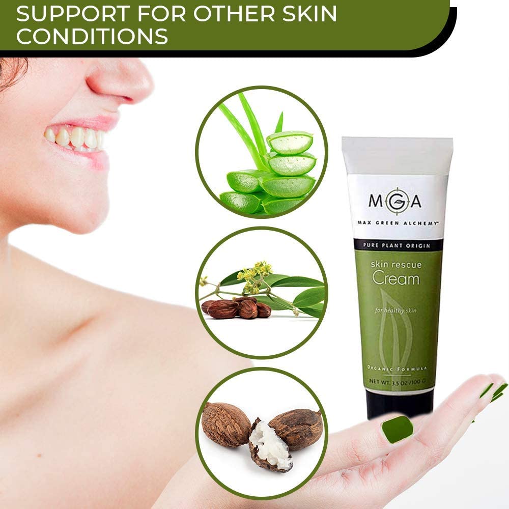 Skin Rescue Cream 2 Ounce Jar- Hydrating Face and Body Cream for Daily Use – Supports the Treatmen
