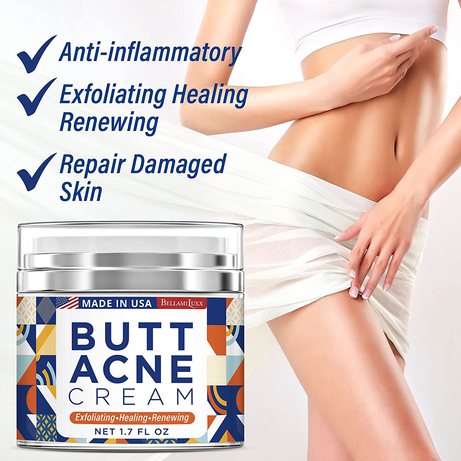 Butt Acne Clearing Cream, Thigh Acne Clearing treatment, Made in USA, Clears Acne, Pimples, and Dark
