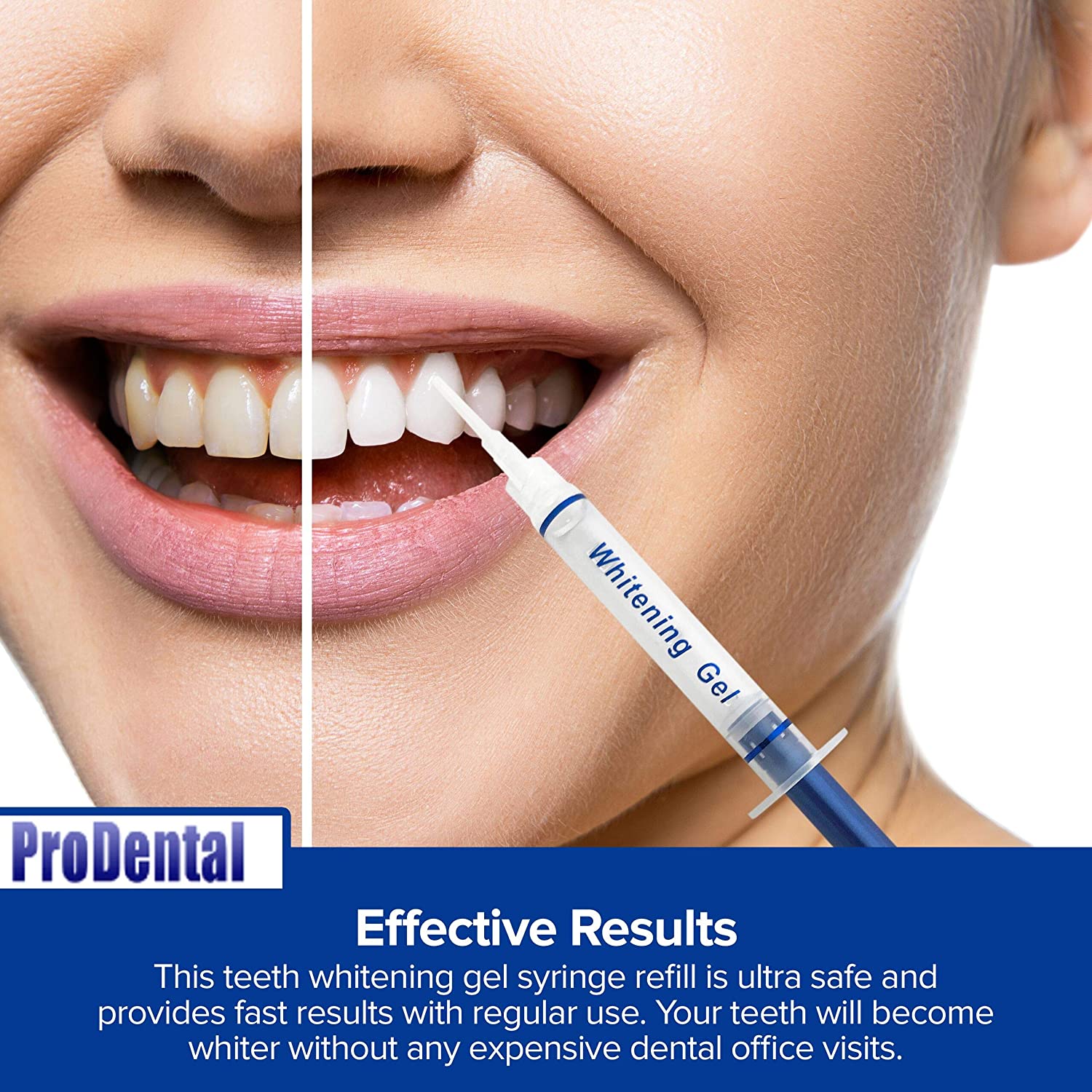 ProDental Teeth Whitening Gel Syringe Refill 8 Pack | 35% Carbamide Peroxide - 48 Treatments | Faste