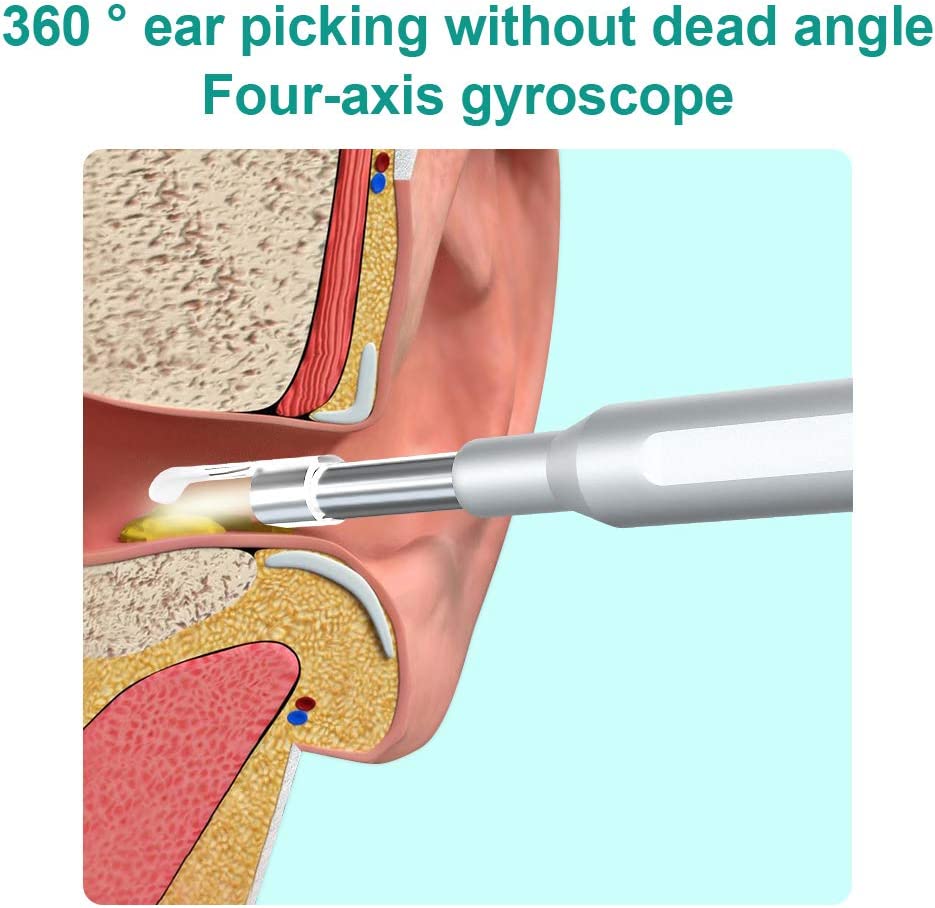 Ear Wax Removal Tool Camera Smart Visual Ear Wax Cleaner 5 Million HD Visual Ear Pick Luminous Ear