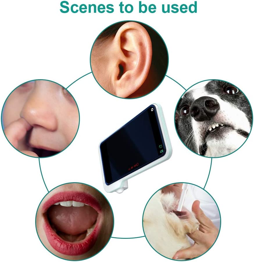 Ear Wax Removal Tool Camera Smart Visual Ear Wax Cleaner 5 Million HD Visual Ear Pick Luminous Ear