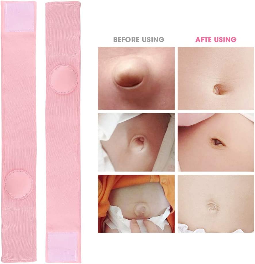 Umbilical Hernia Belt, Baby Belly Button Band, 2pcs Children Infant Baby Umbilical Hernia Belt, Infa