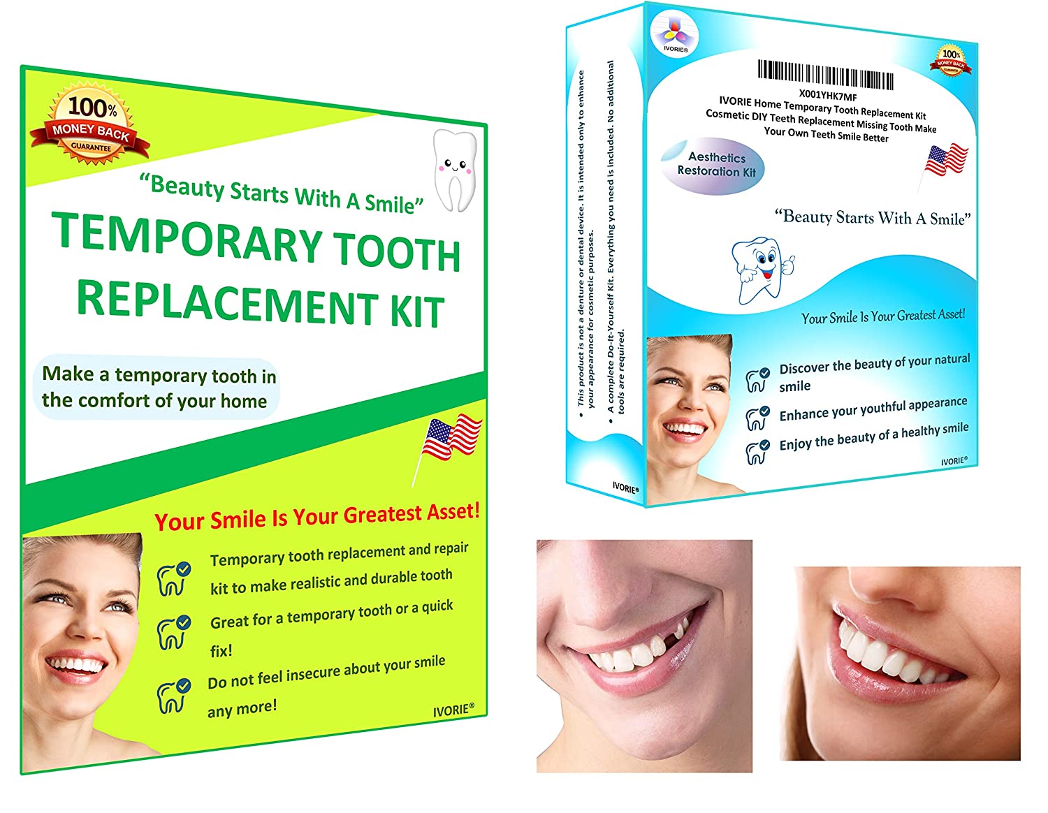 IVORIE Cosmetic Home Temporary Tooth Replacement Kit DIY Teeth