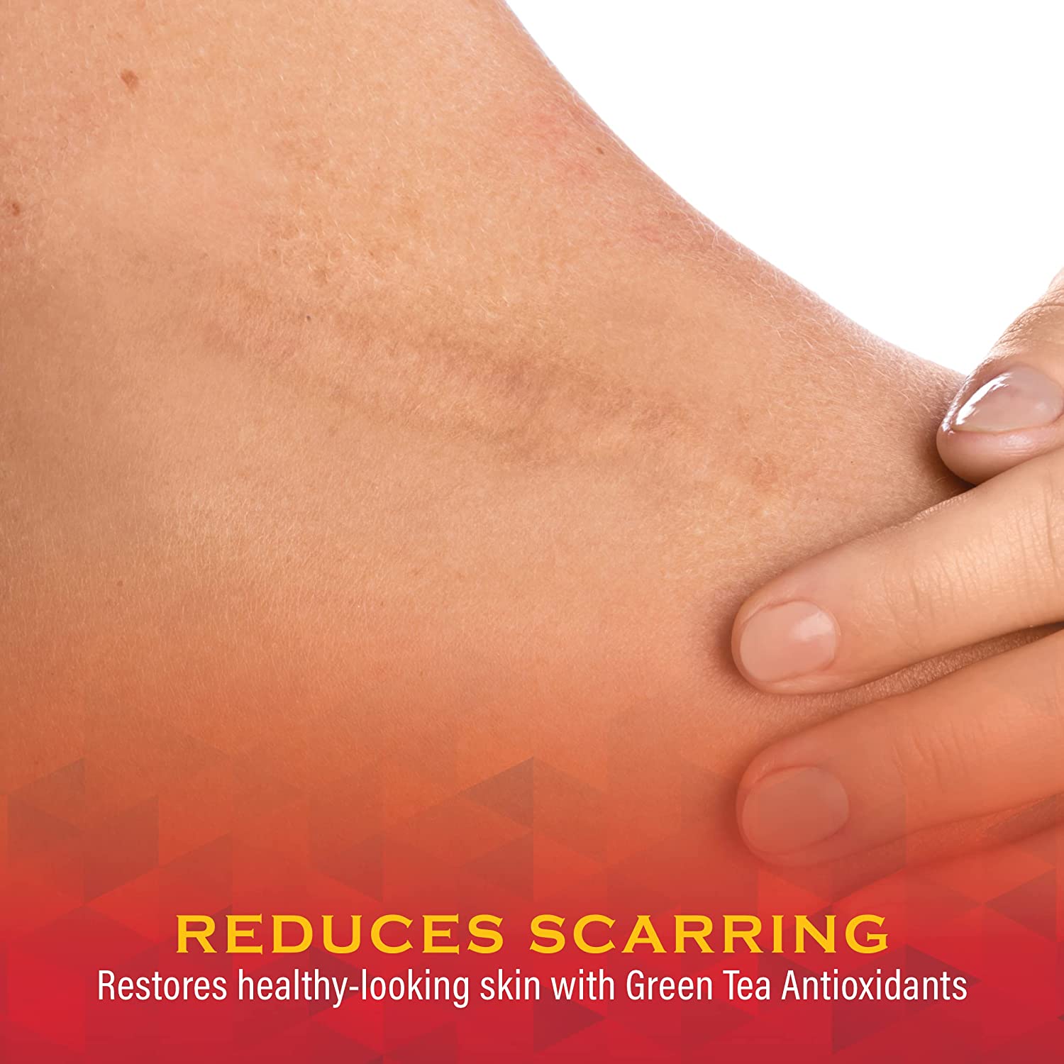 Scar Zone Burn Pain Relief Gel, Extra Strength Topical Analgesic, Treats Minor Cuts, Burns and Abras