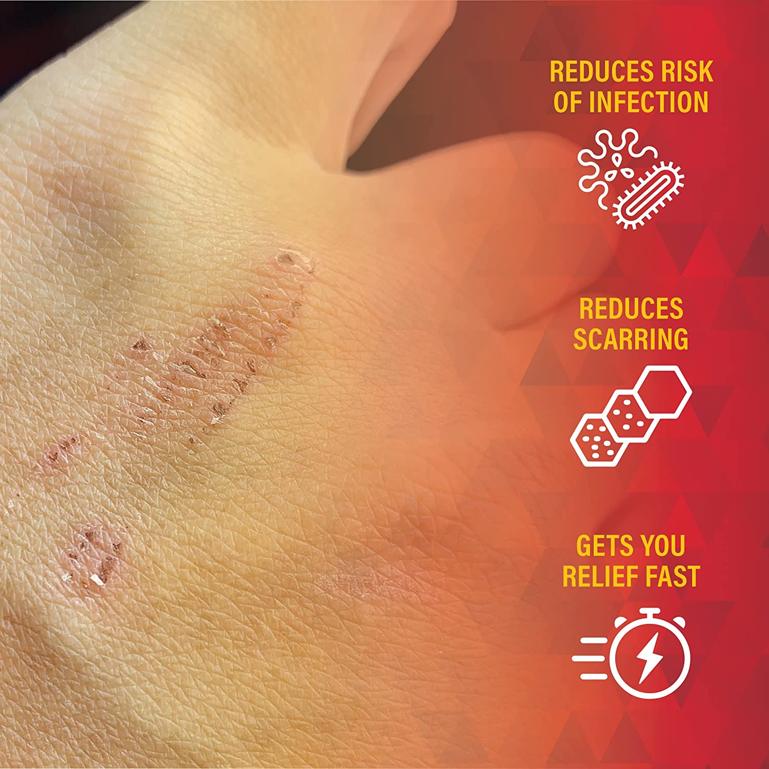 Scar Zone Burn Pain Relief Gel, Extra Strength Topical Analgesic, Treats Minor Cuts, Burns and Abras