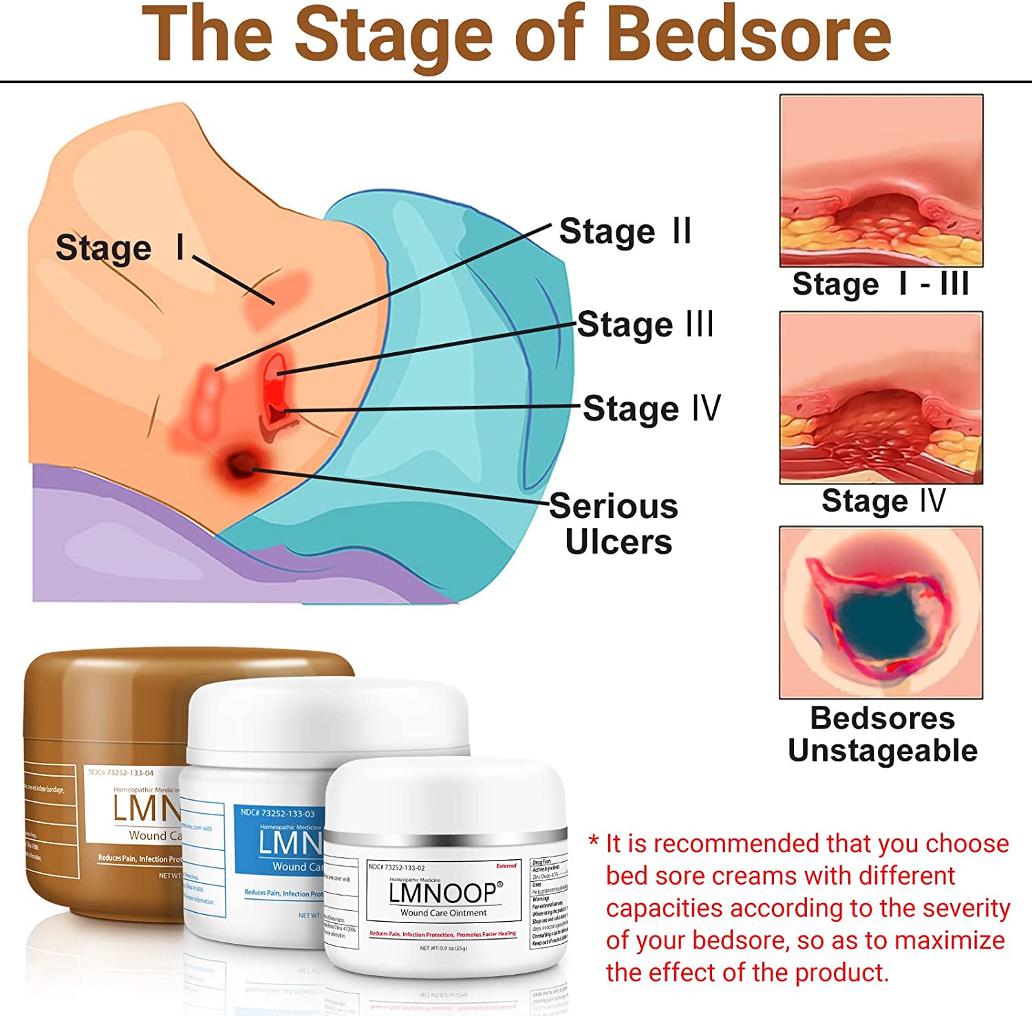 Bed Sore Cream, Organic Bedsore Ointment, Bed Sores Treatment, Fast Wound Healing & 24 hr Infection 